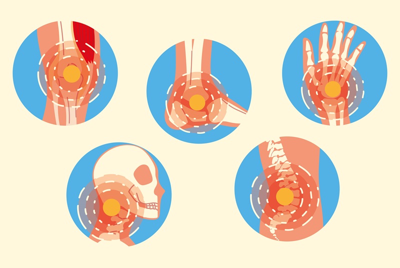 Das Bild zeigt verschiedene Gelenke, die von Arthritis betroffen sind.